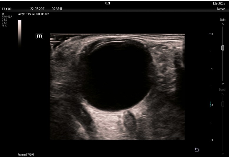 Diagnostic Ultrasound Machines