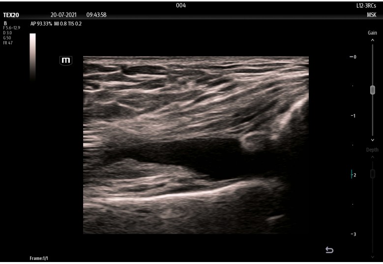Diagnostic Ultrasound Machines
