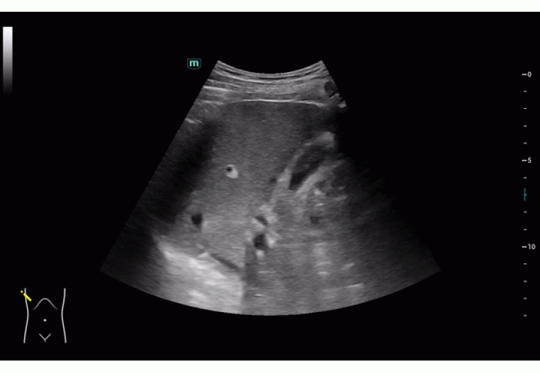 Diagnostic Ultrasound Machines