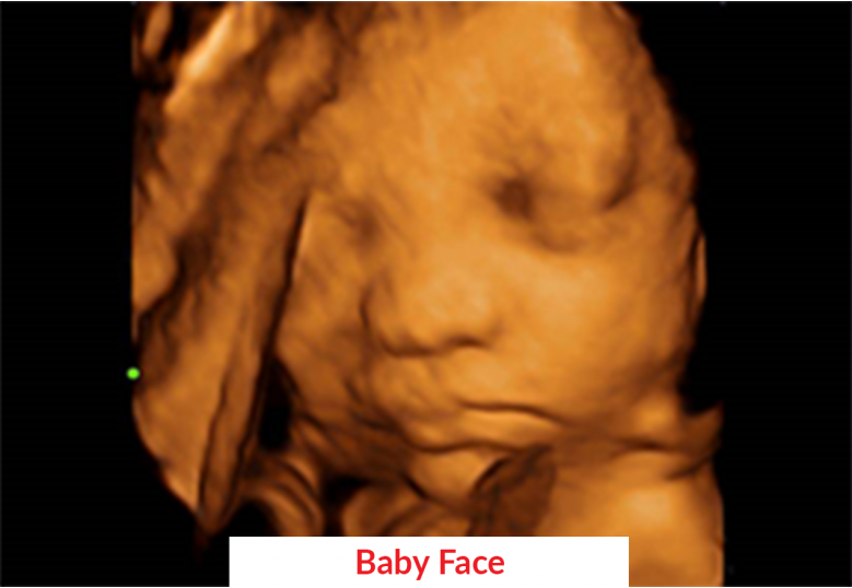 Diagnostic Ultrasound Machines
