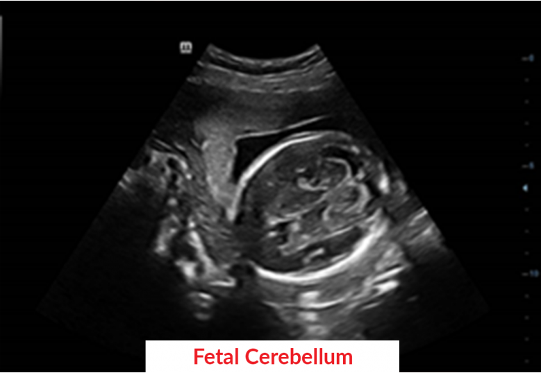 Diagnostic Ultrasound Machines