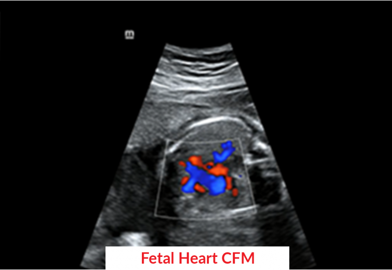 Diagnostic Ultrasound Machines