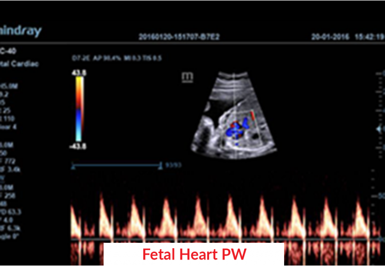 Diagnostic Ultrasound Machines