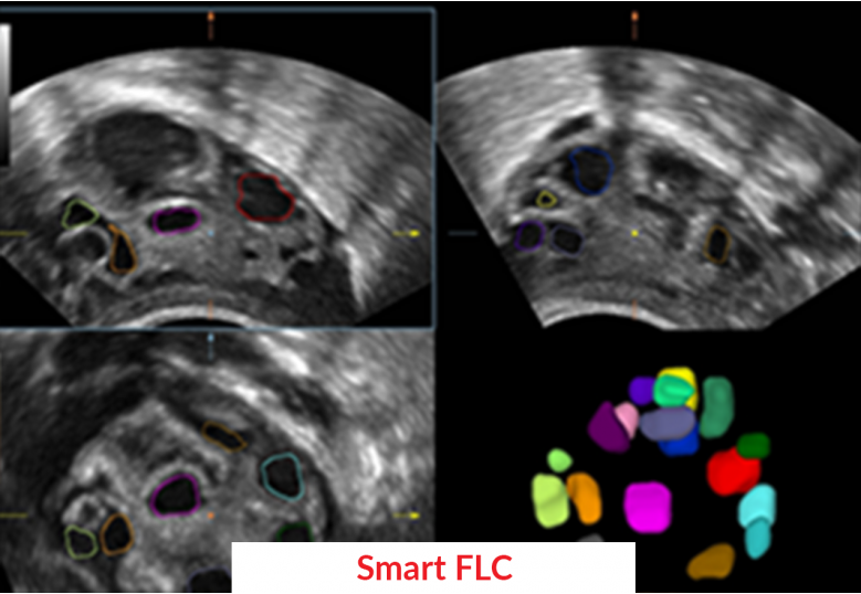 Diagnostic Ultrasound Machines