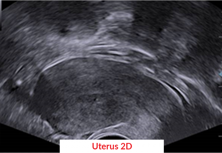 Diagnostic Ultrasound Machines