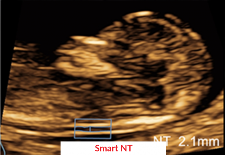 Diagnostic Ultrasound Machines
