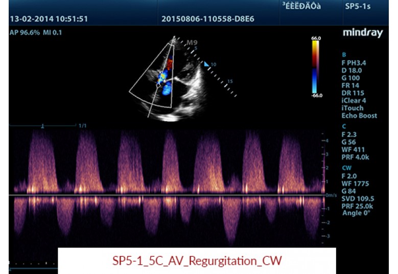 Diagnostic Ultrasound Machines