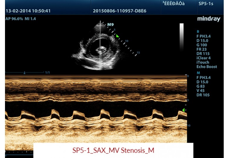 Diagnostic Ultrasound Machines
