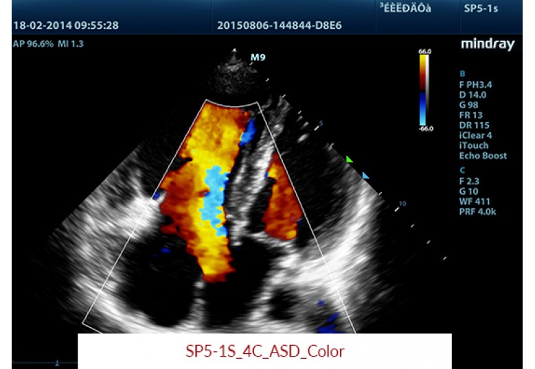 Diagnostic Ultrasound Machines