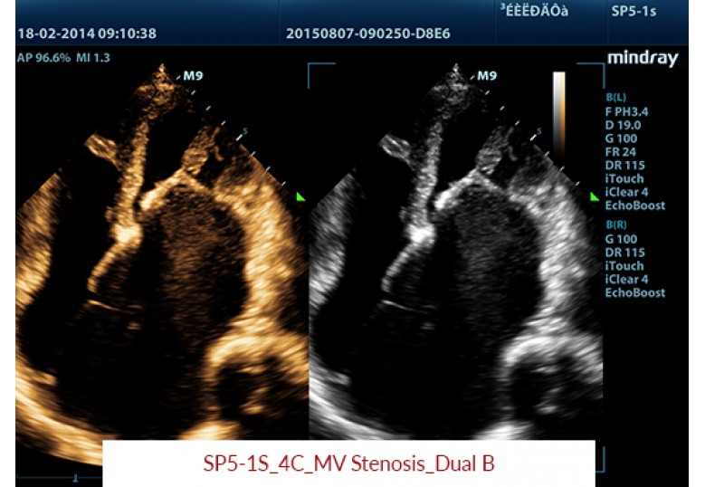Diagnostic Ultrasound Machines