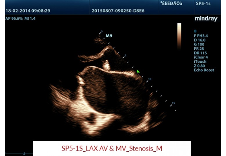 Diagnostic Ultrasound Machines