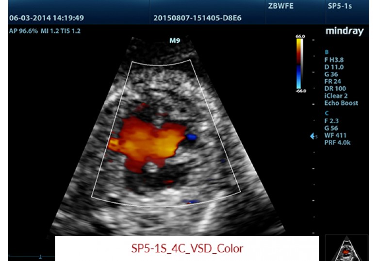 Diagnostic Ultrasound Machines