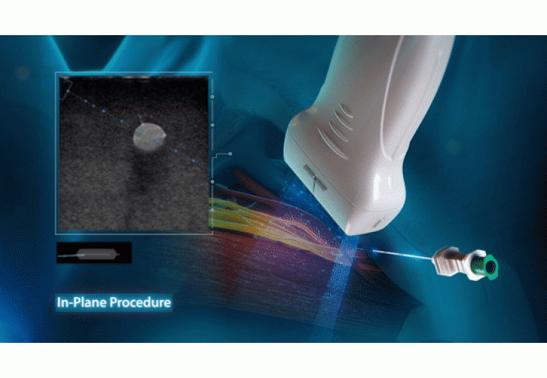 Diagnostic Ultrasound Machines